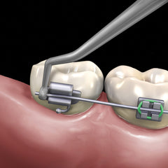 Distal Cinch Back Hand Instrument